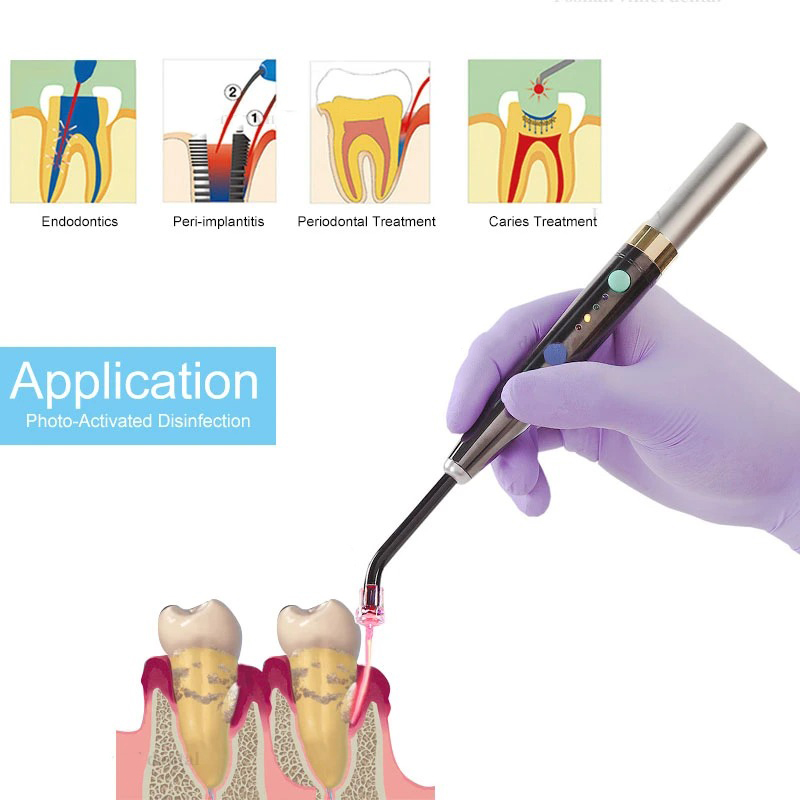 نظام ليزر الأسنان اللاسلكي F3W - مراجعة Diode Laser Module وسعره